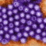 Terrible Stomach Flu Still Going Around: GII.4 Norovirus Update
